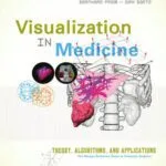 خرید و دانلود نسخه کامل کتاب Visualization in Medicine: Theory, Algorithms, and Applications