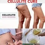 خرید و دانلود نسخه کامل کتاب زبان اصلی HOME & NATURAL REMEDIES FOR CELLULITE CURE: Practical Guide On The Best Remedies To Get Rid Of Your Cellulite : Everything You Need To Know PDF | دانلود کتاب خارجی
