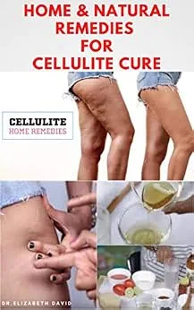 خرید و دانلود نسخه کامل کتاب زبان اصلی HOME & NATURAL REMEDIES FOR CELLULITE CURE: Practical Guide On The Best Remedies To Get Rid Of Your Cellulite : Everything You Need To Know PDF | دانلود کتاب خارجی