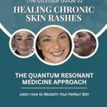 خرید و دانلود نسخه کامل کتاب زبان اصلی The Ultimate Guide To Healing Chronic Skin Rashes: The Quantum Resonant Medicine Approach – Learn How To Reclaim Your Perfect Skin PDF | دانلود کتاب خارجی