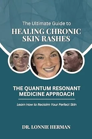 خرید و دانلود نسخه کامل کتاب زبان اصلی The Ultimate Guide To Healing Chronic Skin Rashes: The Quantum Resonant Medicine Approach – Learn How To Reclaim Your Perfect Skin PDF | دانلود کتاب خارجی_6aaf53ff40d38.jpeg خرید و دانلود نسخه کامل کتاب زبان اصلی The Ultimate Guide To Healing Chronic Skin Rashes: The Quantum Resonant Medicine Approach – Learn How To Reclaim Your Perfect Skin PDF | دانلود کتاب خارجی