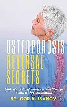خرید و دانلود نسخه کامل کتاب زبان اصلی Osteoporosis Reversal Secrets: Workouts, Diet and Supplements for Stronger Bones Without Medications PDF | دانلود کتاب خارجی_6aa914c6c71fd.jpeg خرید و دانلود نسخه کامل کتاب زبان اصلی Osteoporosis Reversal Secrets: Workouts, Diet and Supplements for Stronger Bones Without Medications PDF | دانلود کتاب خارجی