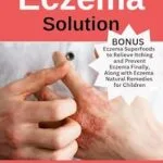 خرید و دانلود نسخه کامل کتاب زبان اصلی The Natural Eczema Solution: A Complete Guide to Healing and Preventing Atopic Dermatitis PDF | دانلود کتاب خارجی