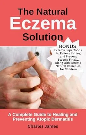 خرید و دانلود نسخه کامل کتاب زبان اصلی The Natural Eczema Solution: A Complete Guide to Healing and Preventing Atopic Dermatitis PDF | دانلود کتاب خارجی_6aaf685ec75cb.jpeg خرید و دانلود نسخه کامل کتاب زبان اصلی The Natural Eczema Solution: A Complete Guide to Healing and Preventing Atopic Dermatitis PDF | دانلود کتاب خارجی