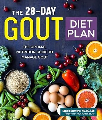 خرید و دانلود نسخه کامل کتاب زبان اصلی The 28-Day Gout Diet Plan: The Optimal Nutrition Guide to Manage Gout | دانلود کتاب خارجی