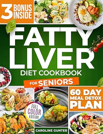 خرید و دانلود نسخه کامل کتاب زبان اصلی Fatty Liver Diet Cookbook for Seniors: Hundreds of Delicious and Easy Recipes to Revitalize and Naturally Detox Your Liver | The Ultimate NAFLD Healing Guide | دانلود کتاب خارجی_6ab8466d89fe1.webp خرید و دانلود نسخه کامل کتاب زبان اصلی Fatty Liver Diet Cookbook for Seniors: Hundreds of Delicious and Easy Recipes to Revitalize and Naturally Detox Your Liver | The Ultimate NAFLD Healing Guide | دانلود کتاب خارجی