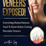 خرید و دانلود نسخه کامل کتاب زبان اصلی Porcelain Veneers Exposed!: Everything Dental Patients Need To Know Before Getting Porcelain Veneers Kindle Edition PDF | دانلود کتاب خارجی