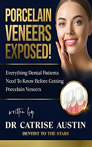 خرید و دانلود نسخه کامل کتاب زبان اصلی Porcelain Veneers Exposed!: Everything Dental Patients Need To Know Before Getting Porcelain Veneers Kindle Edition PDF | دانلود کتاب خارجی