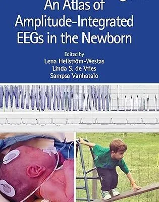 An Atlas of Amplitude-Integrated EEGs in the Newborn (3rd Edition) - Orginal Pdf