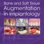 خرید و دانلود دانلود کتاب Bone and Soft Tissue Augmentation in Implantology original pdf