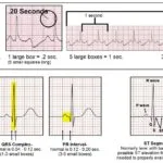 خرید و دانلود جزوه تفسیر ECG برای پرستاران
